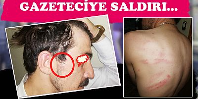 Samsun'da Gazeteciye Doğalgaz Borusu ile Saldırı...